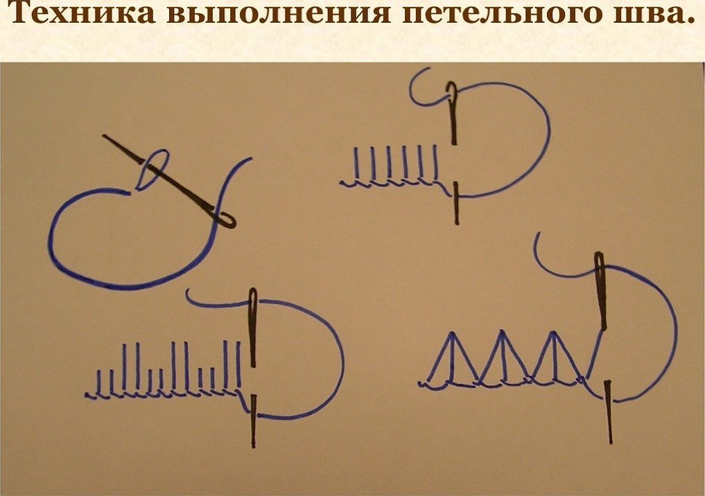 Выполнение петельного шва